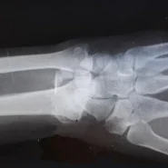 Sex Pistols tour reschedule - Sex Pistols Tour Reschedule to Accommodate Guitarist's 'Picking Fatigue'